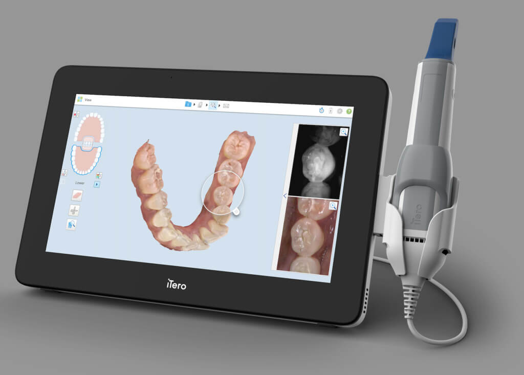 3d dental scan machine