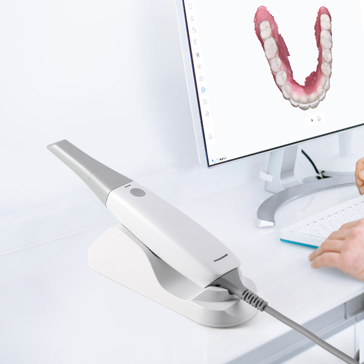 3d teeth scan cost