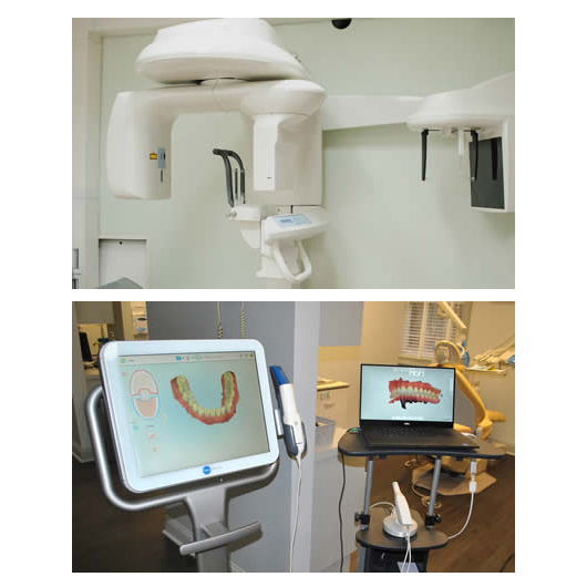 Affordable Dental Implant Costs