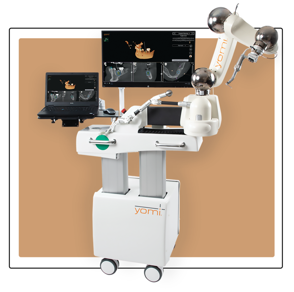 All On 4 Dental Implants Cost Dental Equipment