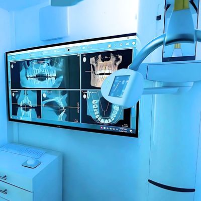 All On 4 Dental Implants Cost Mexico