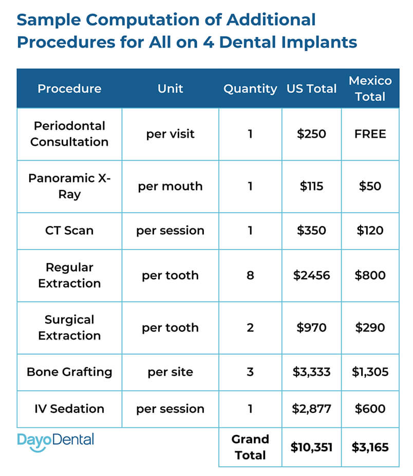 Average Cost Of All On 4 Dental Implants