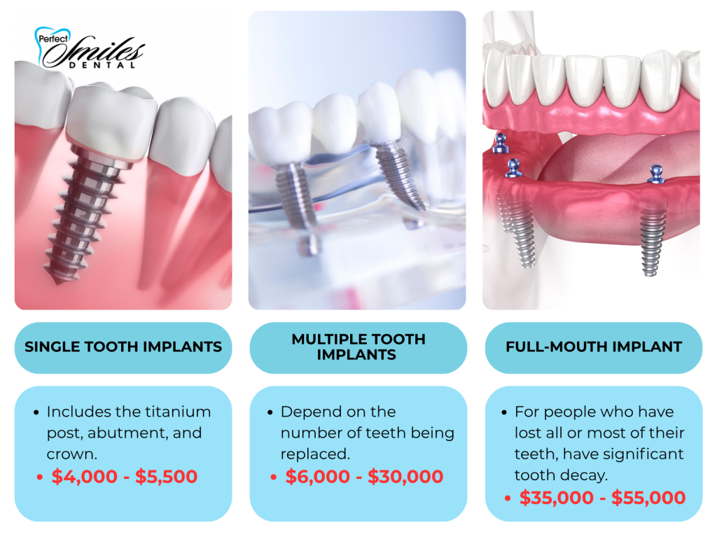 Average Cost Of Dental Implants Per Tooth