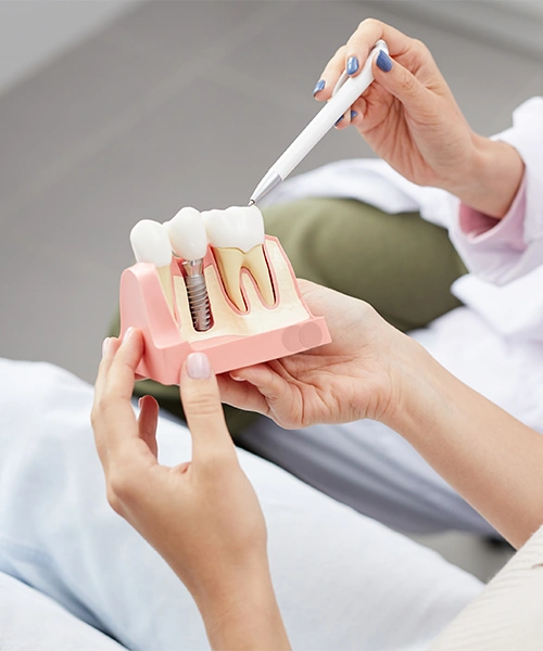 Cost Of Dental Implants In Fresno Dental Equipment