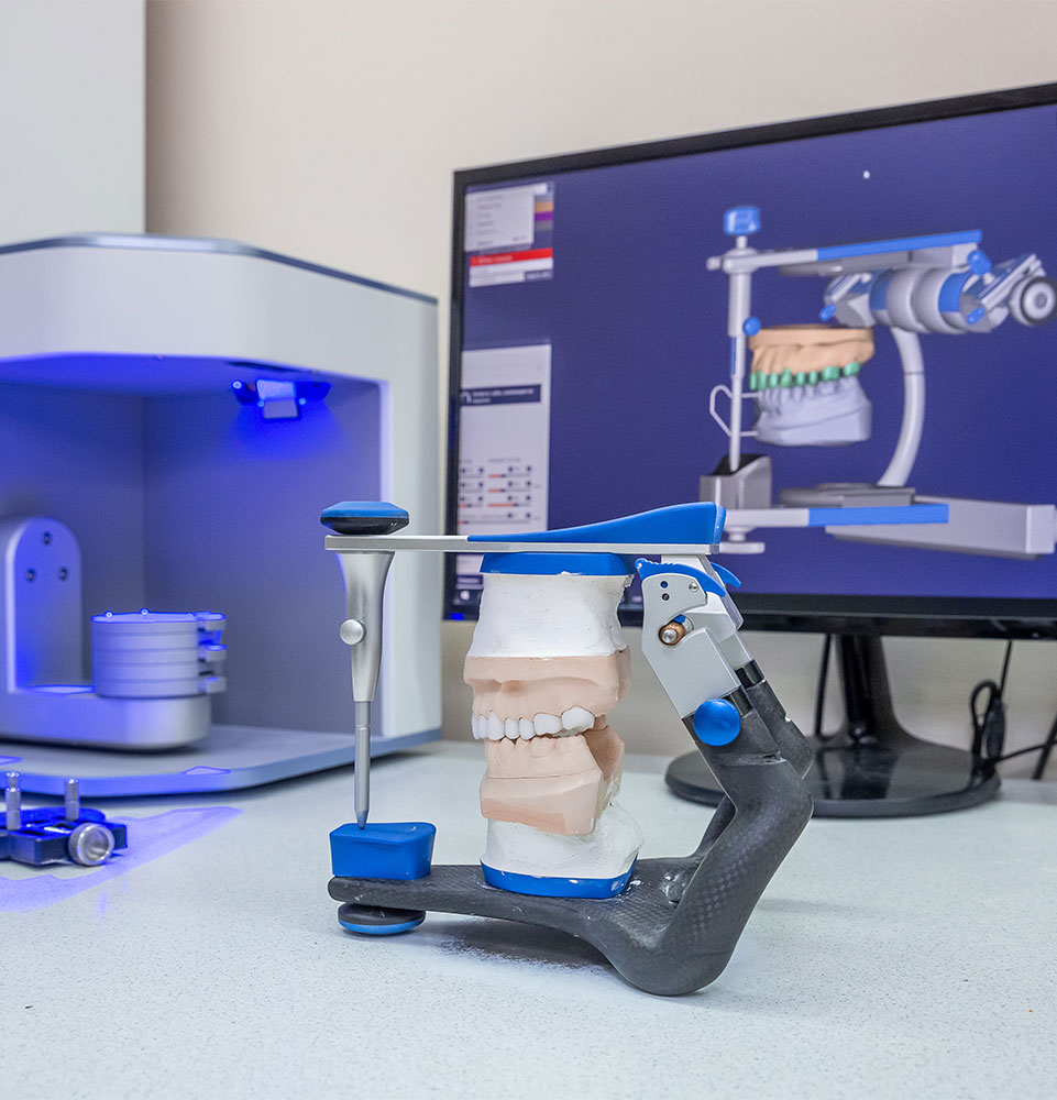 Cost Of Dental Implants In Fresno