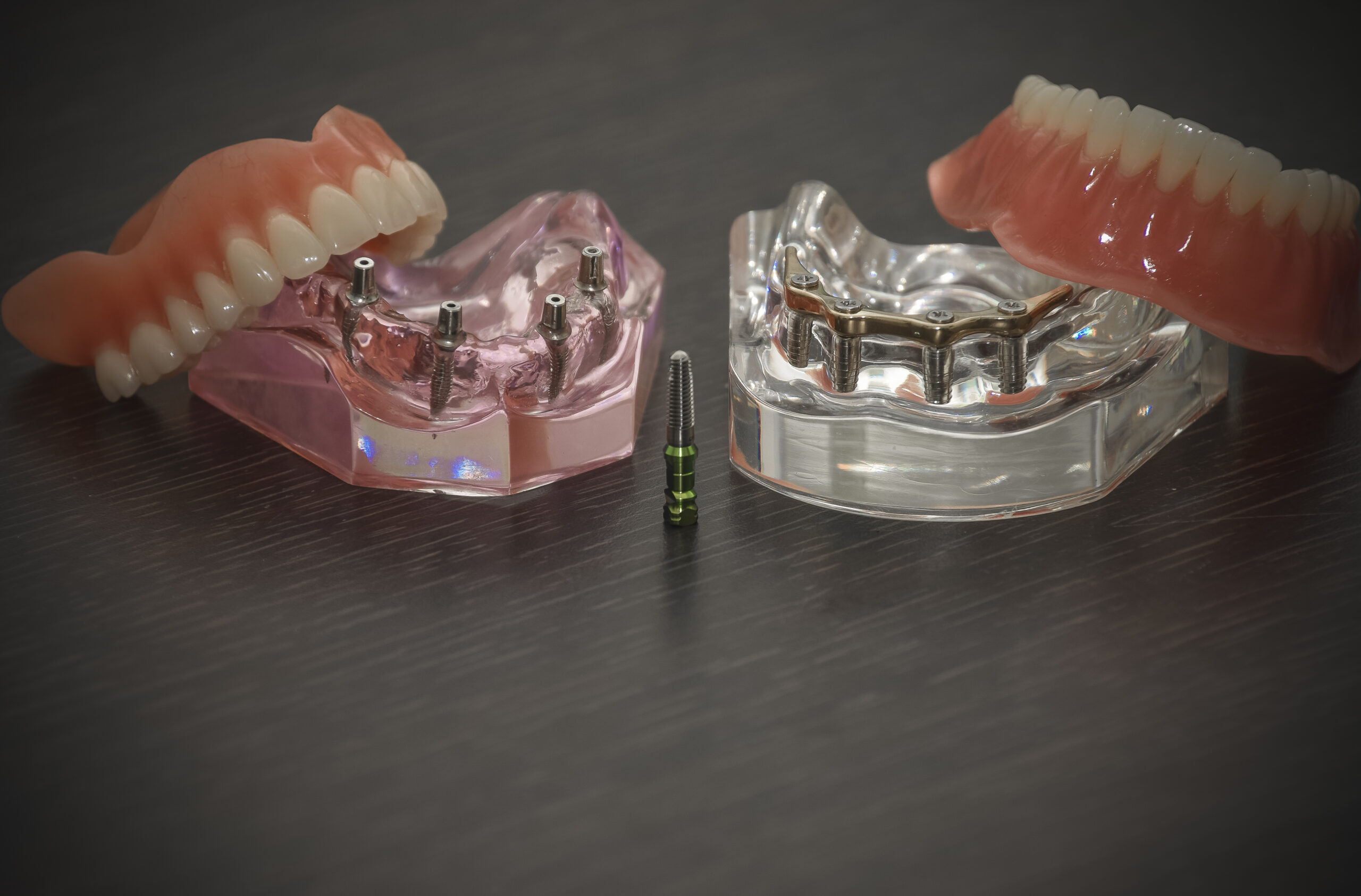 Costa Rica Dental Implants Price