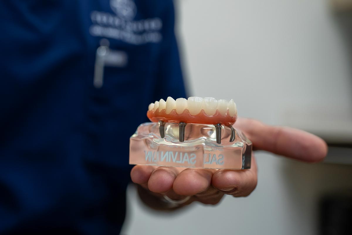 Dental Implants Dallas Cost