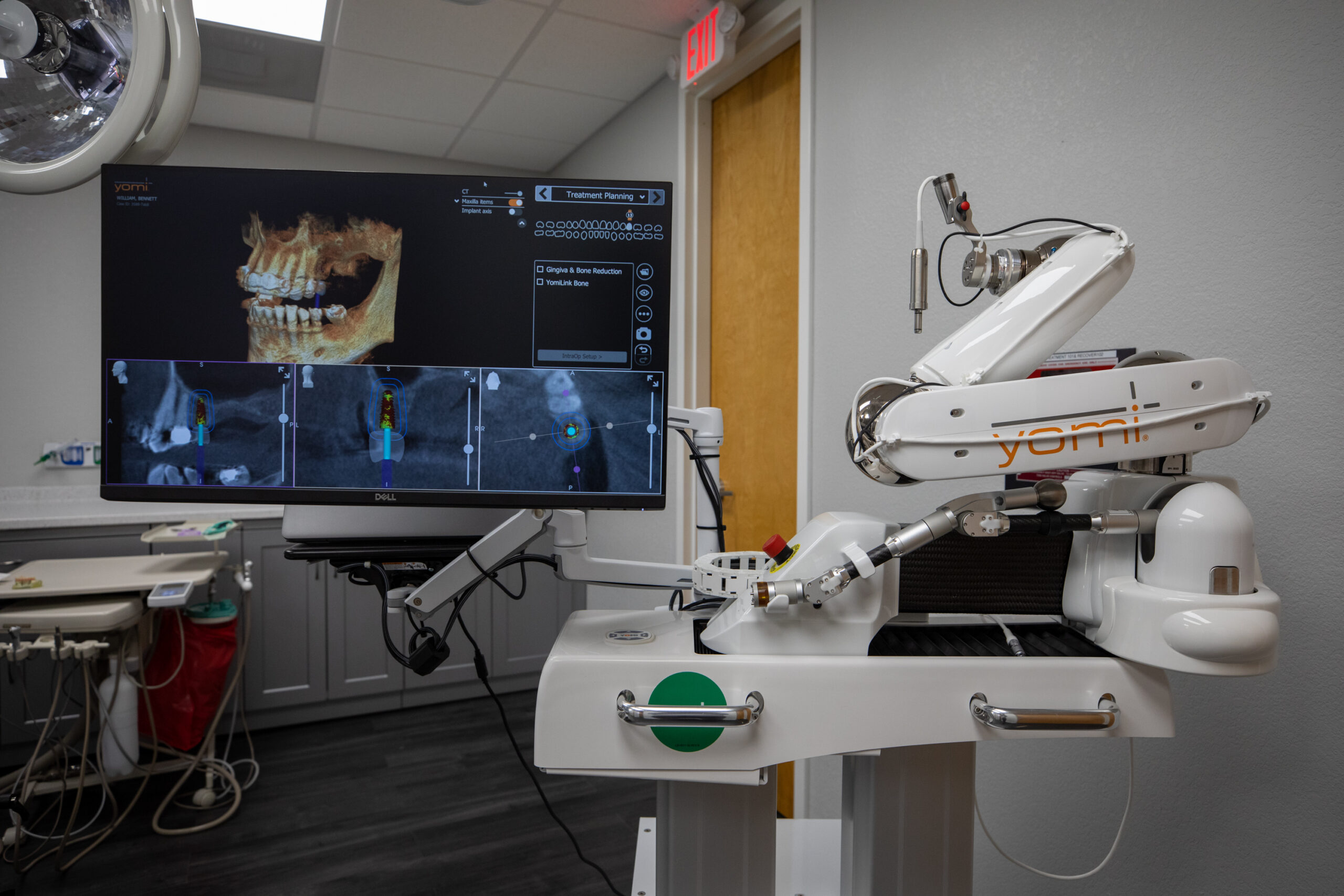 Dental Implants Florida Low Cost