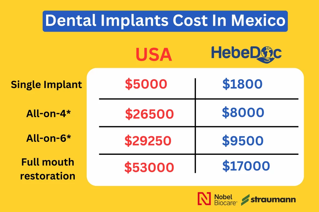 How Much Do Dental Implants Cost In Mexico