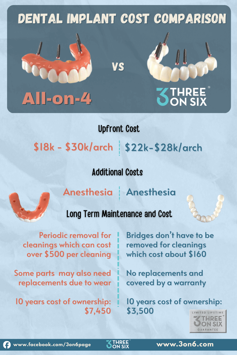 How Much Does A Full Mouth Of Dental Implants Cost