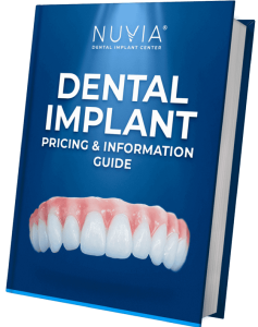 How Much Does Nuvia Dental Implants Cost