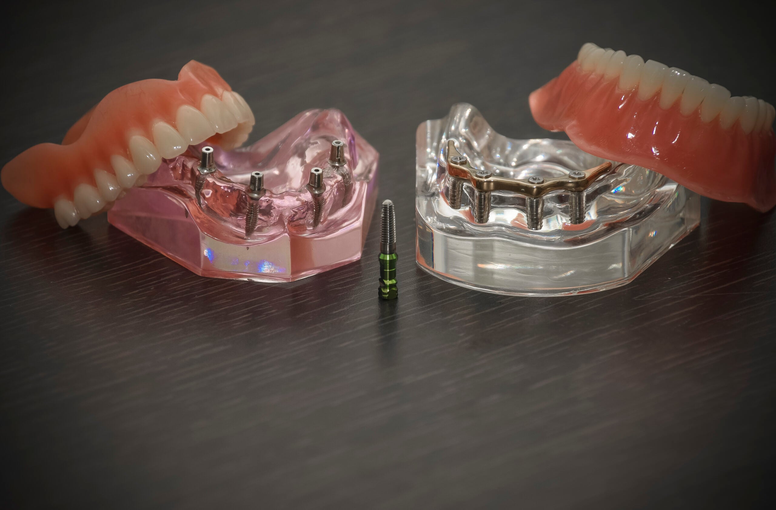 Is It Safe To Get Dental Implants In Costa Rica