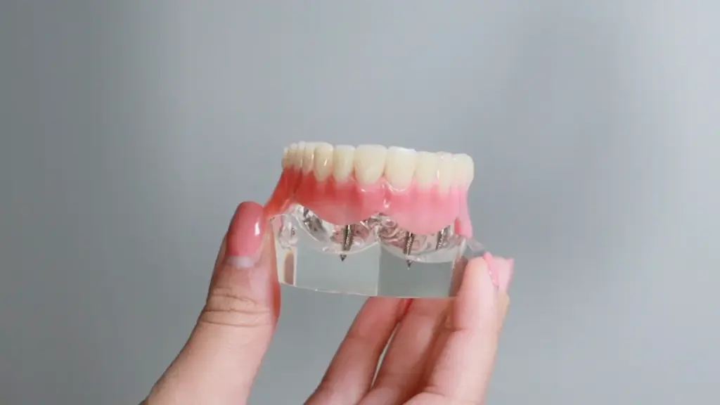 Nuvia Dental Implant Cost Dental Equipment