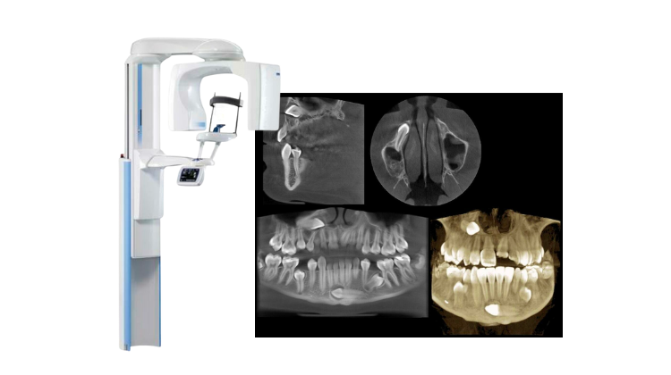 best cbct machine