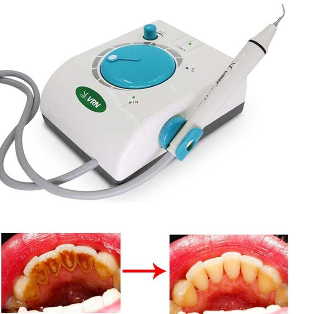 best teeth cleaning machine