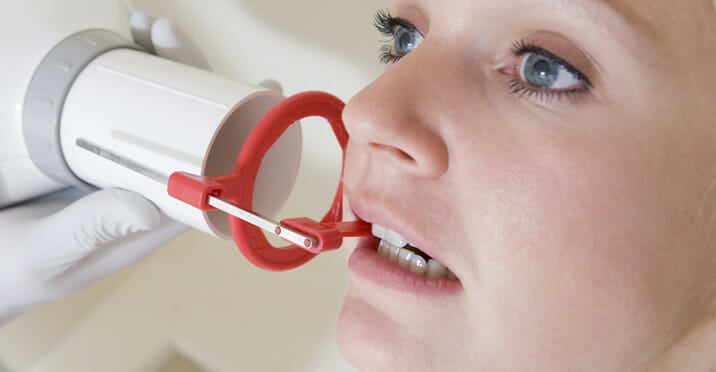 bitewing x ray machine