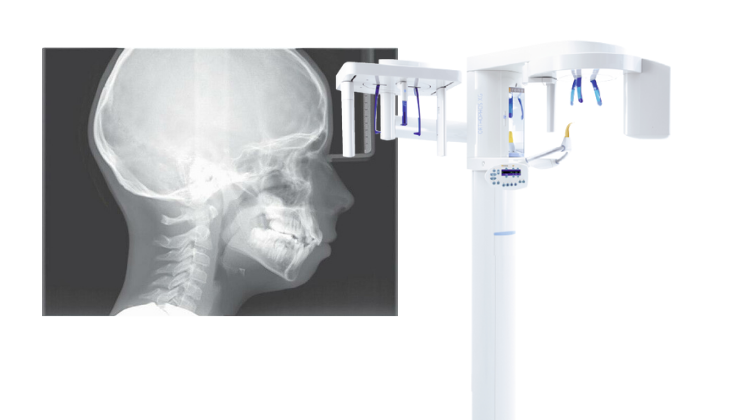 cephalometric radiograph machine