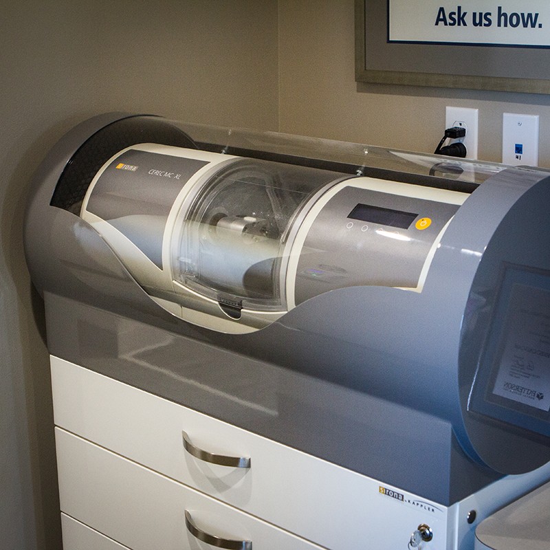 cerec dental crown machine