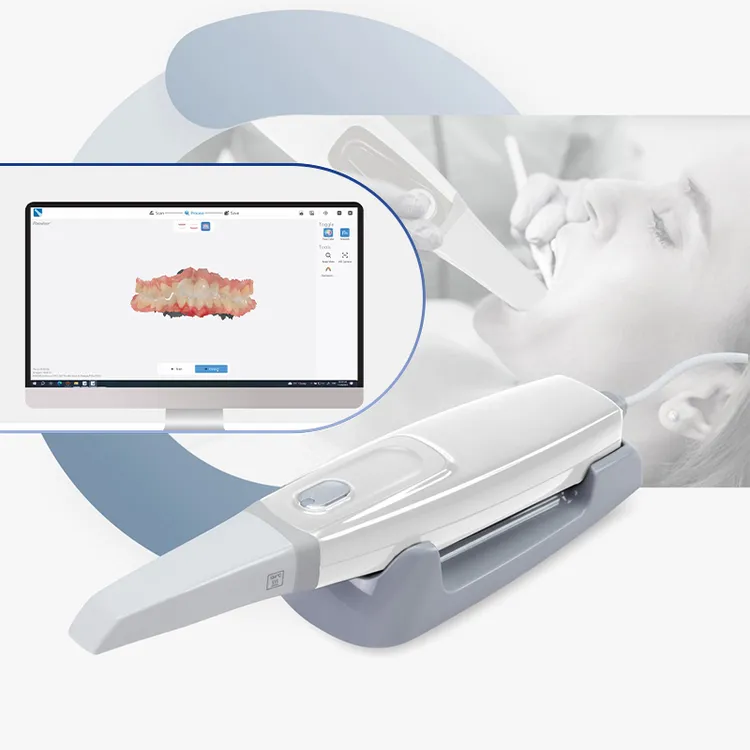 cheap intraoral scanner