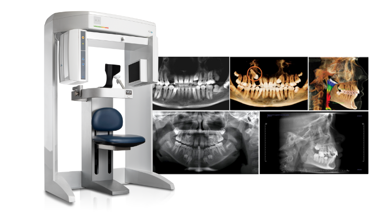cone beam ct scan cost