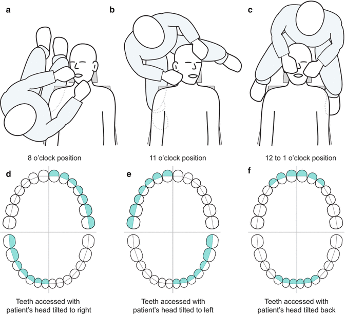 dental chair positions for patient