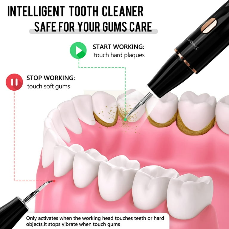 dental equipment to remove plaque