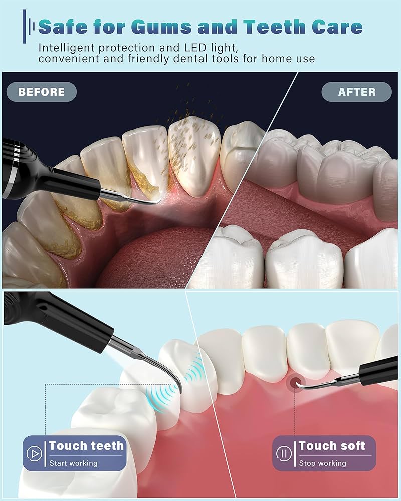 dental equipment to remove plaque