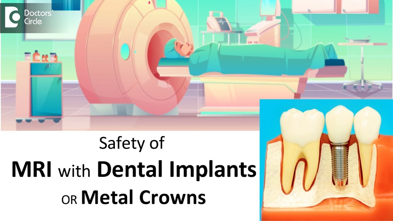 dental implant mri machine