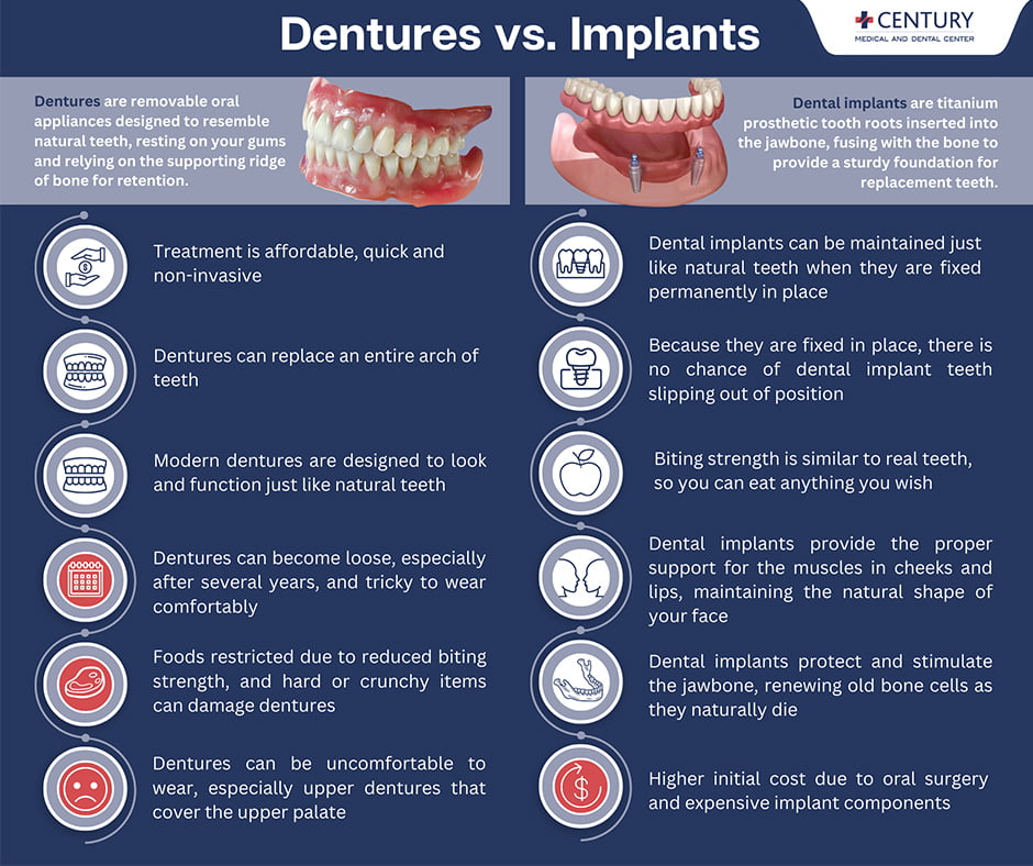 dental implants vs dentures cost