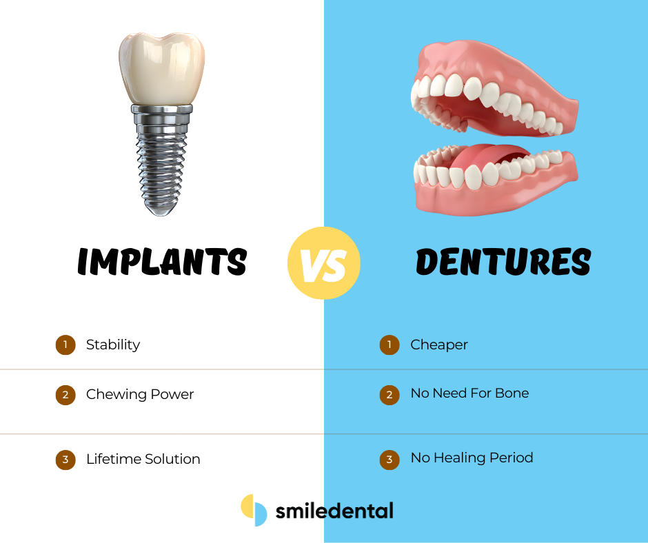 dental implants vs dentures cost