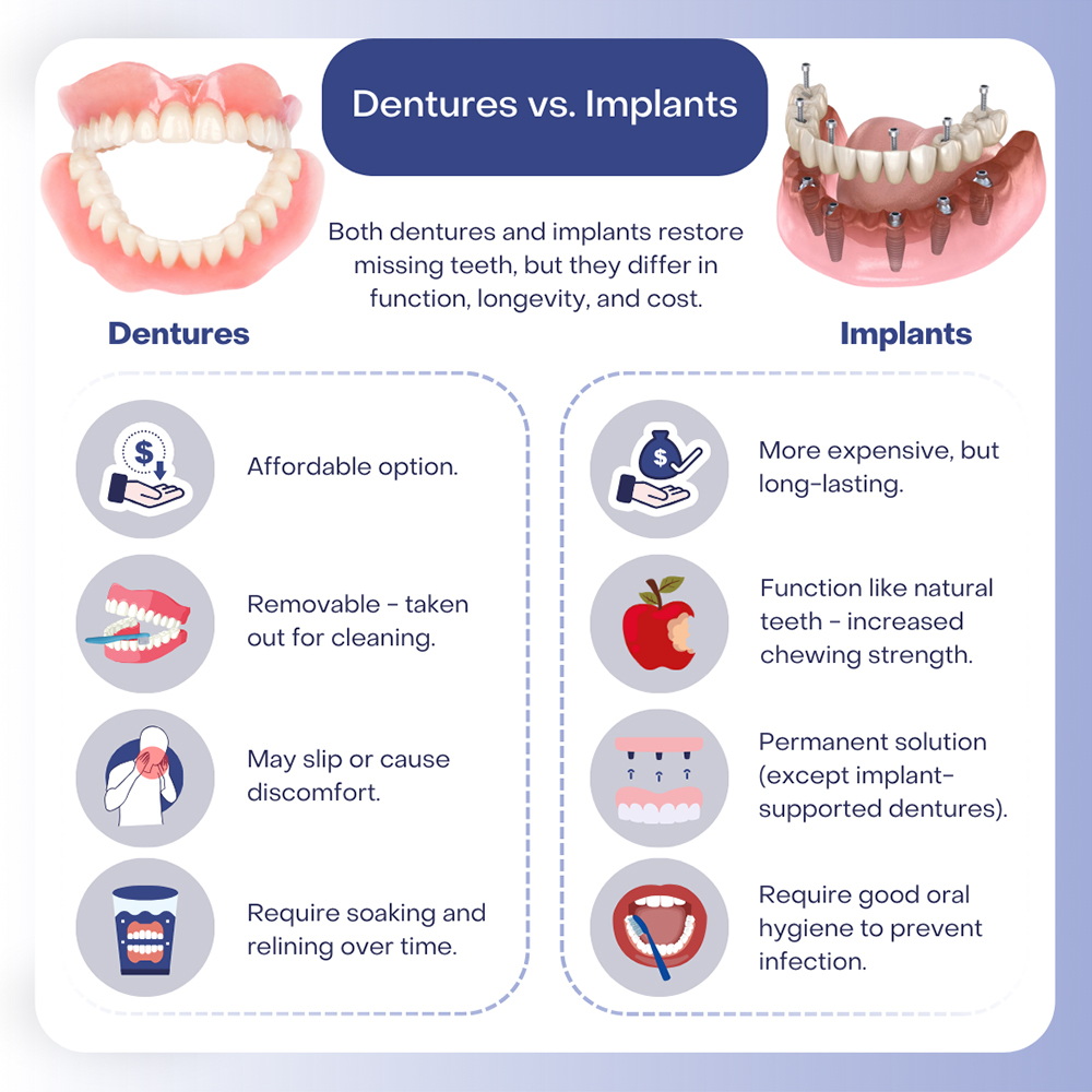 dental implants vs dentures cost