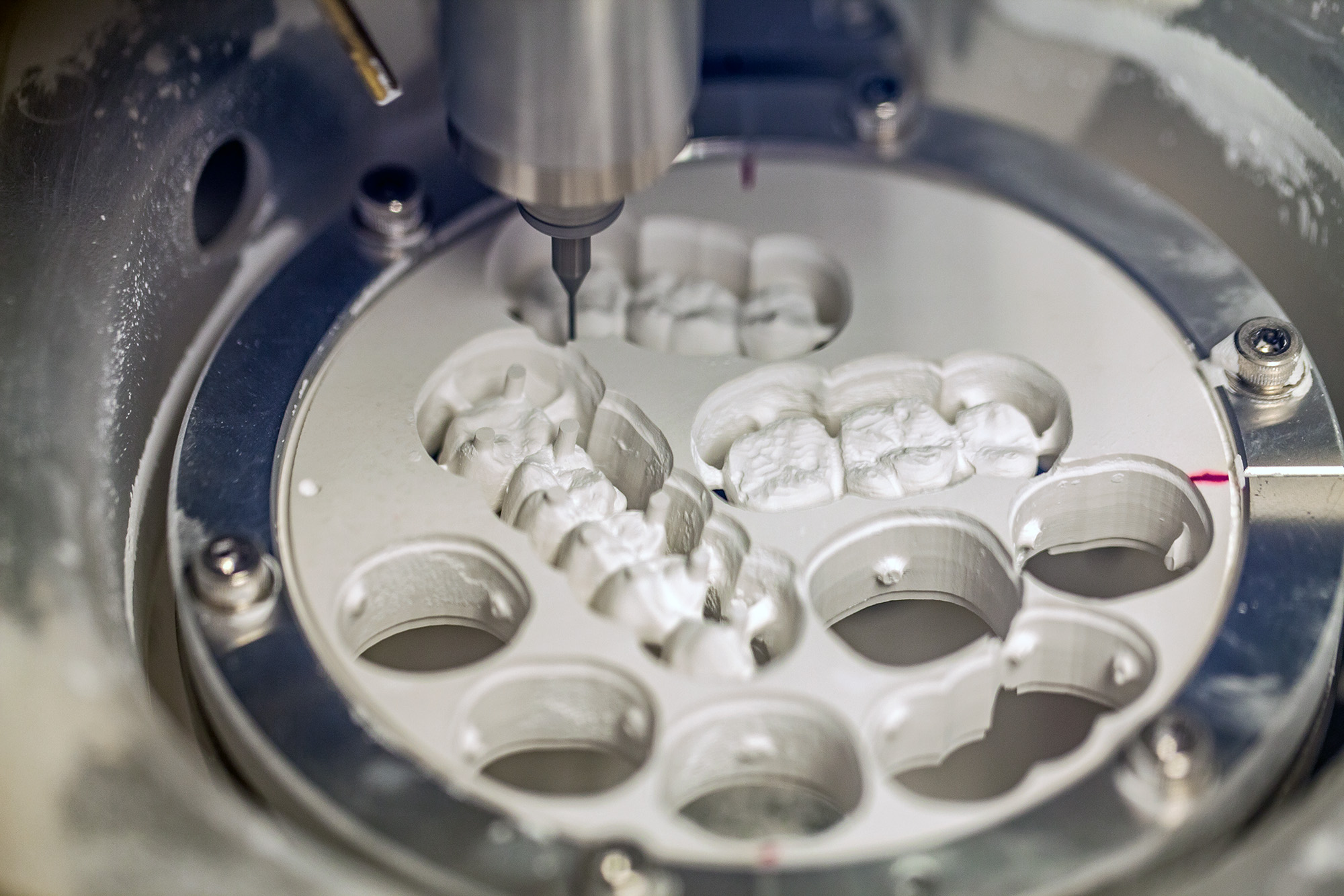 dental milling technology