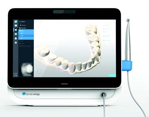 dental wings intraoral scanner