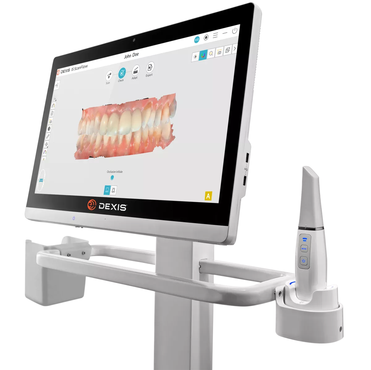 dexis intraoral scanner