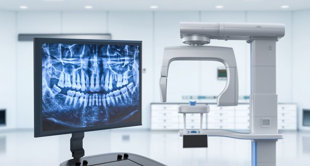 digital dental x ray machine