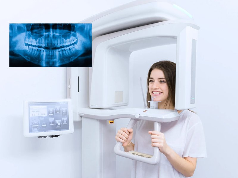 digital opg x ray machine