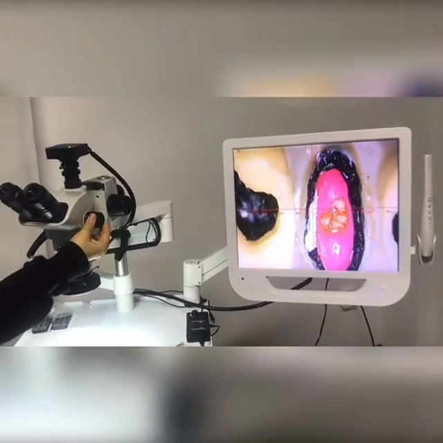 endo microscope cost