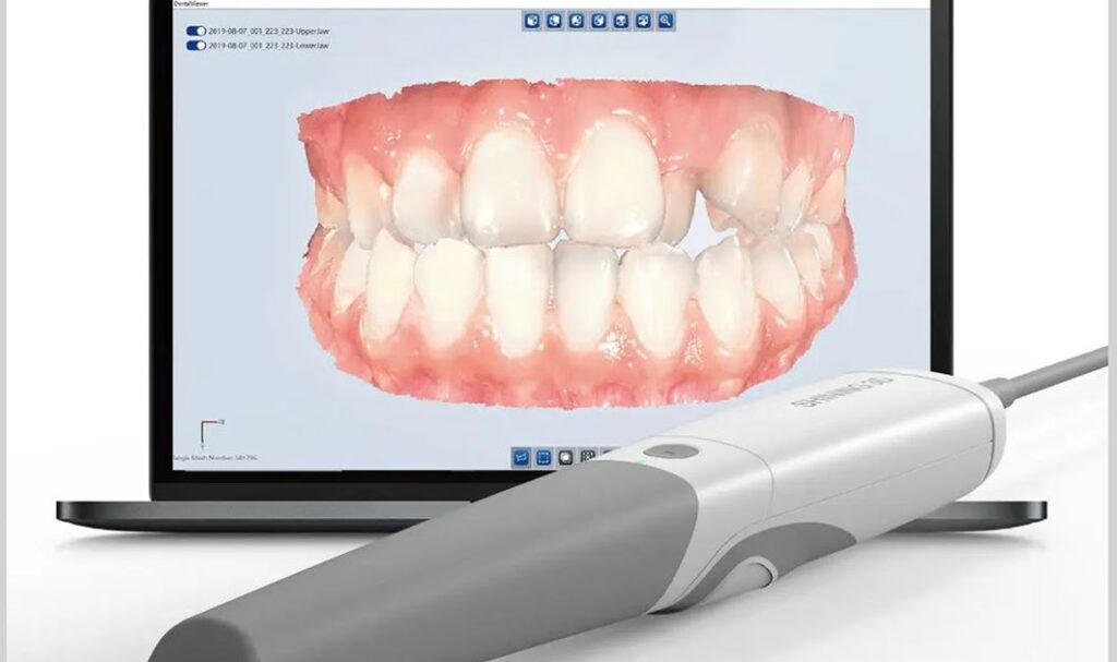 how does scanner work Dental Equipment