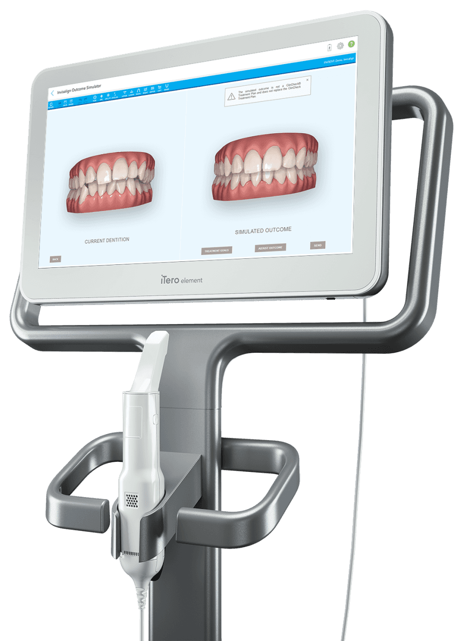 how much does an itero scanner cost