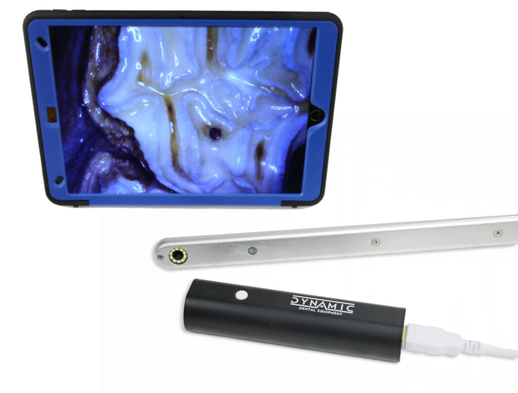 Intra Oral Camera Price for Dental Clinics: Sourcing & Price Guide 2026