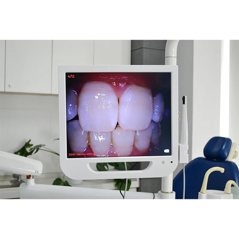 intra oral camera with screen