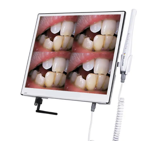 intra oral camera with screen