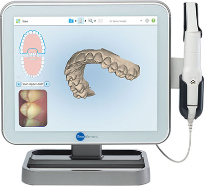 intra oral scanners for digital impression