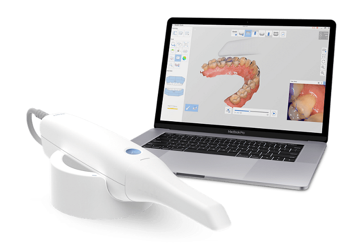 intraoral scanner companies