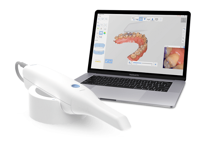 intraoralscanner zahnarzt