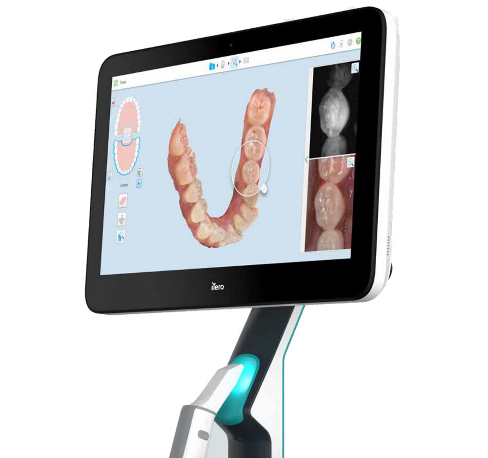 invisalign scanner