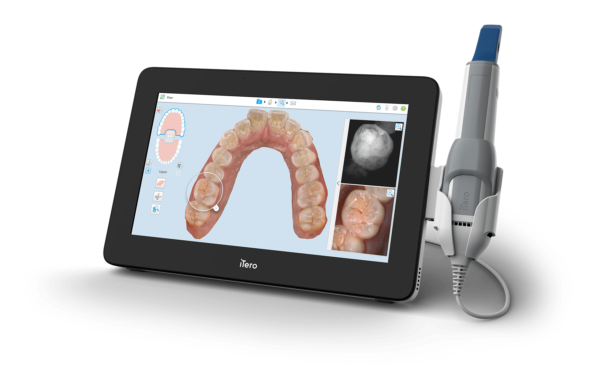 invisalign scanner cost