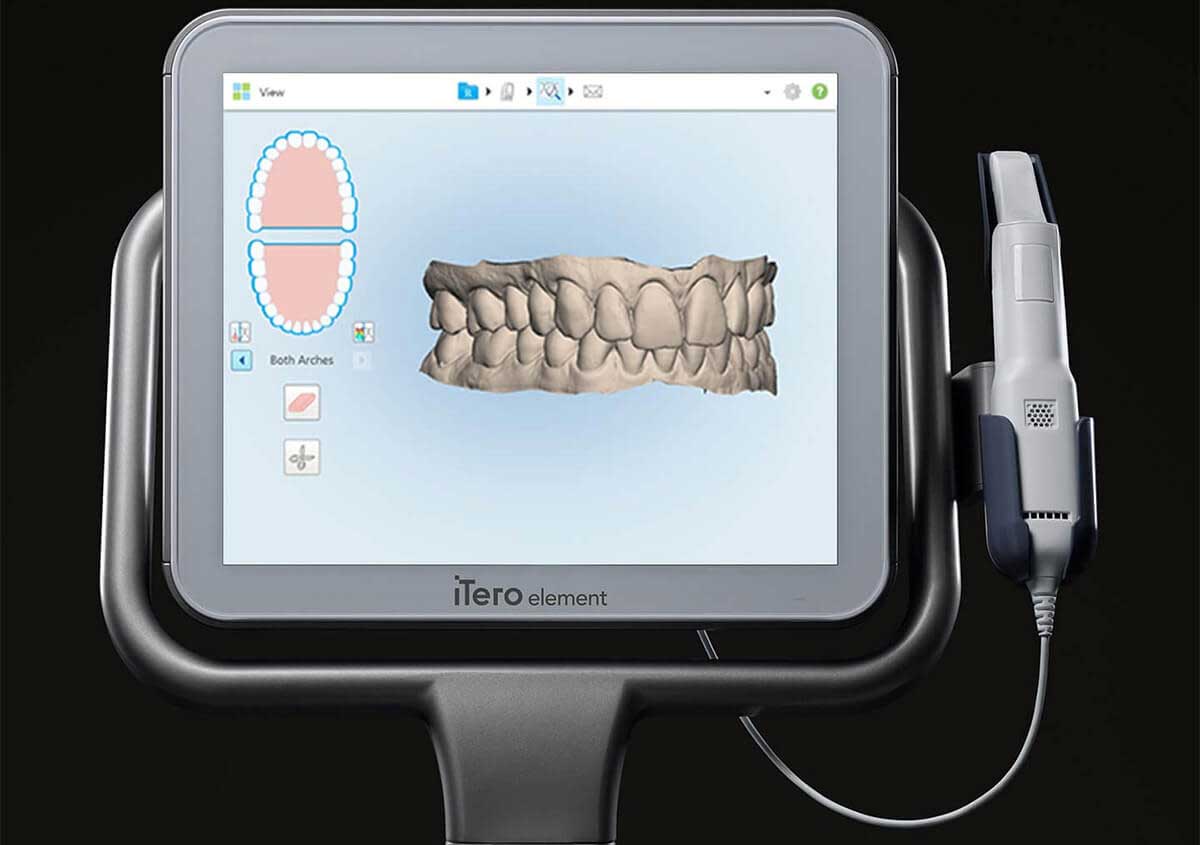 invisalign scanning machine
