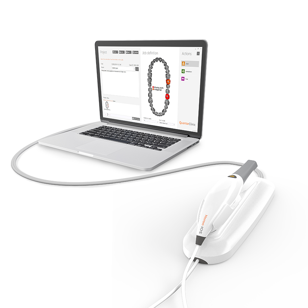 ios scanner Dental Equipment