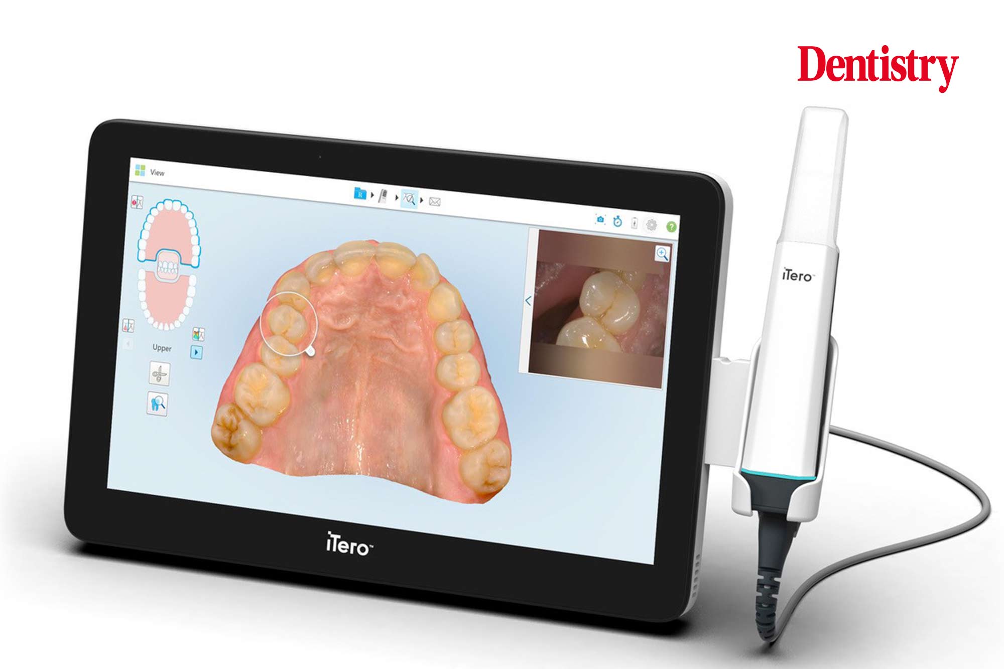 itero edentulous scanning